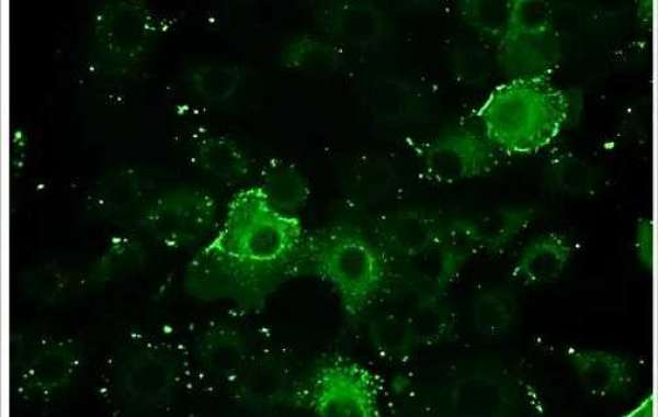 Immunofluorescence Assay Testing Services for Virology Research