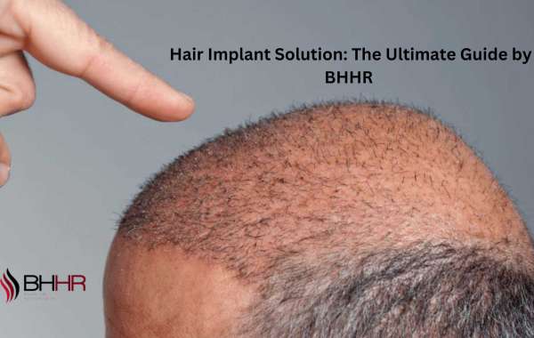 Hair Implant Solution: The Ultimate Guide by BHHR