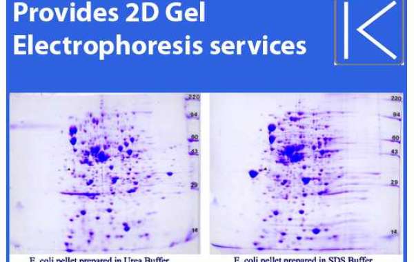 What Makes 2D Electrophoresis a Powerful Protein Analysis Tool?