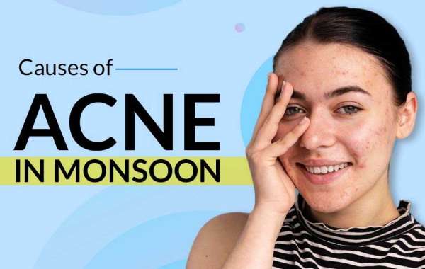 Effective Acne Homeopathic Treatment in Delhi - HomoeoAmigo