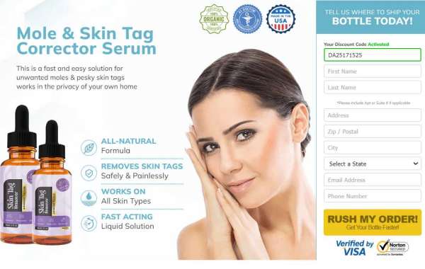 Natural Skin Essence Skin Tag Remover (USA) Official Website, Working, Price & Reviews [Updated 2024]