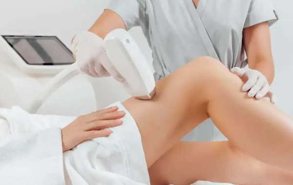 Laser Hair Removal in Dallas, TX: Why Sleek Laser Solutions is Your Best Choice